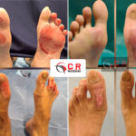 Burn & Reconstructive Surgery