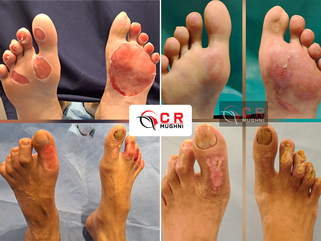 Burn & Reconstructive Surgery